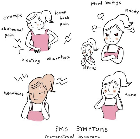 PMS: Premenstrual Syndrome, diagnosis, symptoms, causes, treatments