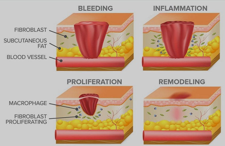 Wounds